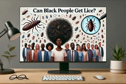 Can Black People Get Lice